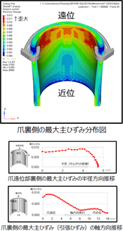 巻き爪マイスター®のシミュレーション